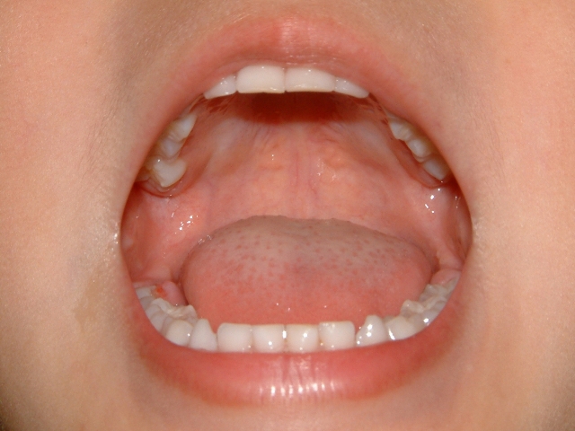 口呼吸のイメージ画像